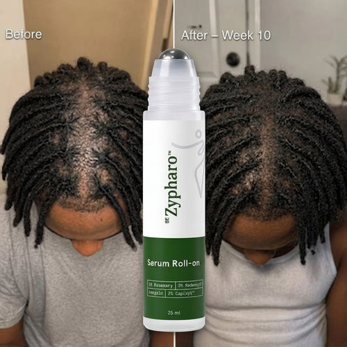 Hair Growth Serum